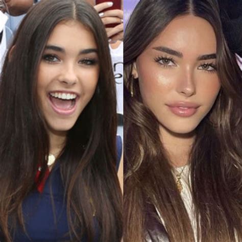 People Think Madison Beer Had a Plastic Surgery,。